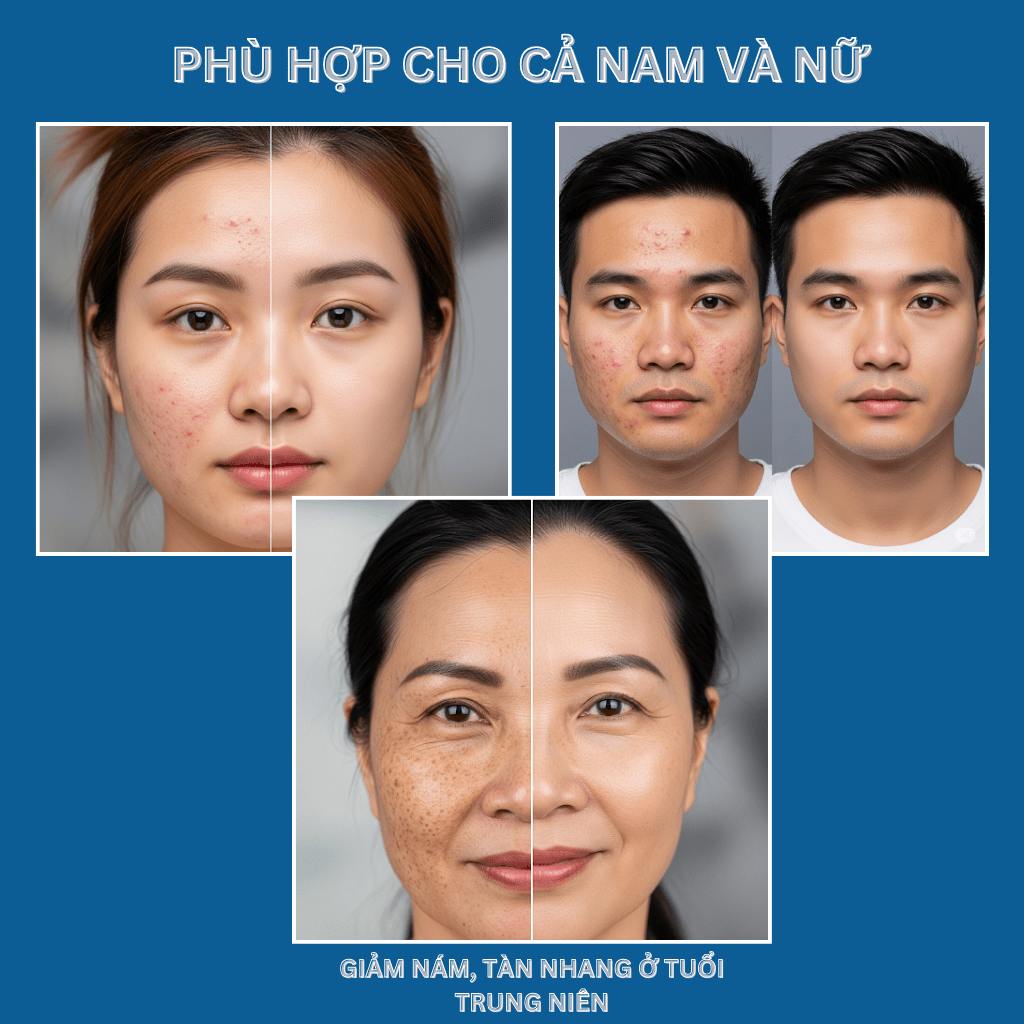 Sữa Rửa Mặt Nusa Dành Cho Da Thường, Dầu & Mụn (150ml).